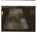 ultrasound2