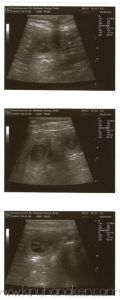 ultrasound2